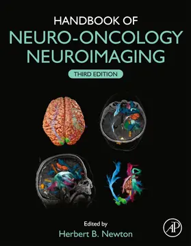 Newton | Handbook of Neuro-Oncology Neuroimaging | Buch | 978-0-12-822835-7 | sack.de