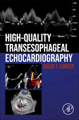 Linker |  High-Quality Transesophageal Echocardiography | Buch |  Sack Fachmedien