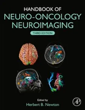 Newton MD in Oncology-Neurosurgery |  Handbook of Neuro-Oncology Neuroimaging | eBook | Sack Fachmedien