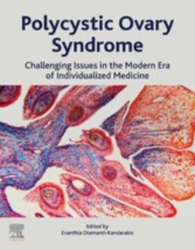 Diamanti-Kandarakis |  Polycystic Ovary Syndrome | eBook | Sack Fachmedien