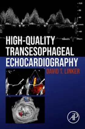 Linker | High-Quality Transesophageal Echocardiography | E-Book | www.sack.de