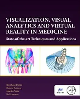 Preim / Raidou / Smit | Visualization, Visual Analytics and Virtual Reality in Medicine | E-Book | sack.de