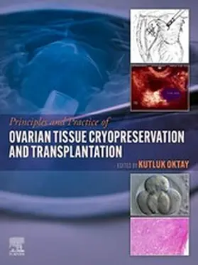 Oktay | Principles and Practice of Ovarian Tissue Cryopreservation and Transplantation | E-Book | www.sack.de
