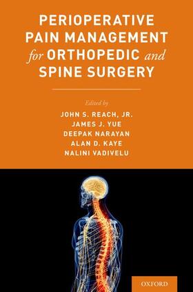 Reach / Yue / Narayan | Perioperative Pain Management for Orthopedic and Spine Surgery | Buch | 978-0-19-062676-1 | sack.de