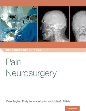 Sagher / Levin / Pilitsis |  Pain Neurosurgery | Buch |  Sack Fachmedien