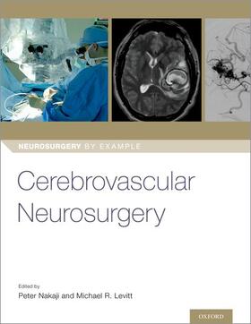Nakaji / Levitt | Cerebrovascular Neurosurgery | Buch | 978-0-19-088772-8 | sack.de