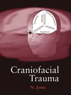 Jones |  Craniofacial Trauma | Buch |  Sack Fachmedien