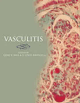 Ball / Bridges |  Vasculitis | Buch |  Sack Fachmedien