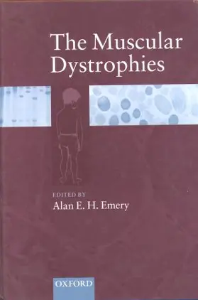 Jones |  Living with Haemophilia | Buch |  Sack Fachmedien
