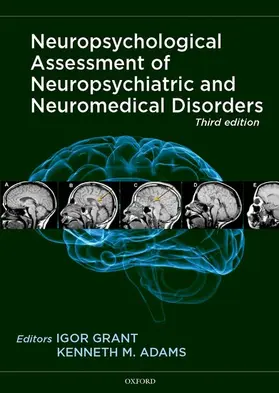 Grant / Adams |  Neuropsychological Assessment of Neuropsychiatric and Neuromedical Disorders | Buch |  Sack Fachmedien