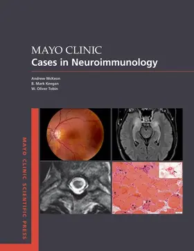 McKeon / Keegan / Tobin |  Mayo Clinic Cases in Neuroimmunology | Buch |  Sack Fachmedien