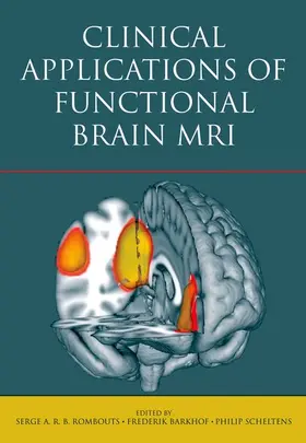 Rombouts / Barkhof / Scheltens |  Clinical Applications of Functional Brain MRI | Buch |  Sack Fachmedien
