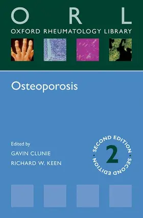 Clunie / Keen |  Osteoporosis | Buch |  Sack Fachmedien