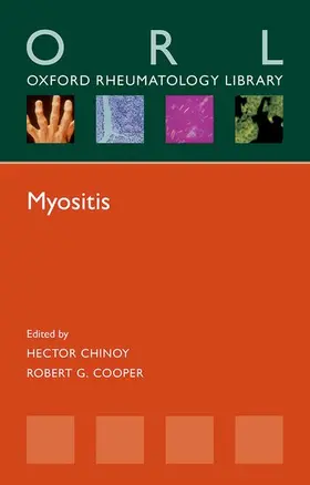 Chinoy / Cooper |  Myositis (Orl) | Buch |  Sack Fachmedien