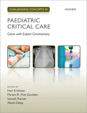Al / Krishnan / Fine-Goulden | Challen Concep Paediat Crit Care Chcon P | Buch | 978-0-19-879459-2 | sack.de