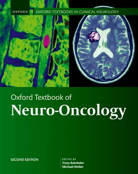 Batchelor / Weller |  Oxford Textbook of Neuro-Oncology | Buch |  Sack Fachmedien