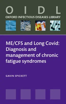 Spickett |  Me/Cfs and Long Covid | Buch |  Sack Fachmedien