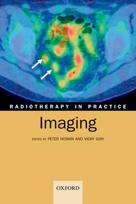 Hoskin / Goh | Radiotherapy in Practice - Imaging | Buch | 978-0-19-923132-4 | sack.de