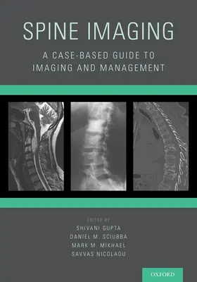 Gupta / Sciubba / Mikhael |  Spine Imaging | Buch |  Sack Fachmedien