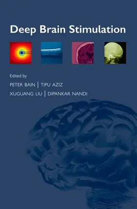 Bain / Aziz / Liu |  Deep Brain Stimulation | Buch |  Sack Fachmedien
