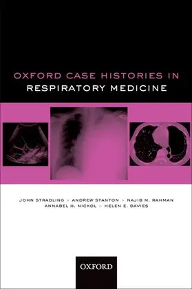 Stradling / Stanton / Rahman |  Oxford Case Histories in Respiratory Medicine | Buch |  Sack Fachmedien