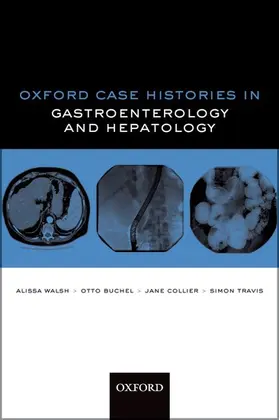Walsh / Buchel / Collier |  Oxford Case Histories in Gastroenterology and Hepatology | Buch |  Sack Fachmedien