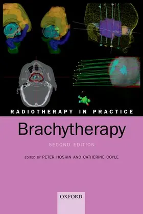 Hoskin / Coyle |  Radiotherapy in Practice - Brachytherapy | Buch |  Sack Fachmedien
