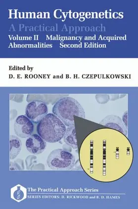  Human Cytogenetics: A Practical Approach: Volume II: Malignancy and Acquired Abnormalities | Buch |  Sack Fachmedien
