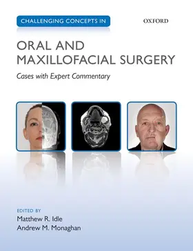 Idle / Monaghan | Challenging Concepts in Oral and Maxillofacial Surgery | Buch | 978-0-19-965355-3 | sack.de