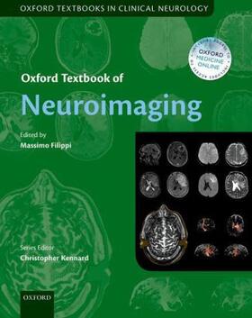 Filippi |  Neuroimaging Otcn C | Buch |  Sack Fachmedien