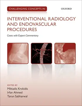 Krokidis / Ahmed / Sabharwal | Challenging Concepts in Interventional Radiology | Buch | 978-0-19-966438-2 | sack.de