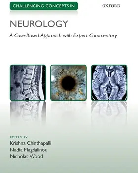 Chinthapalli / Magdalinou / Wood |  Challenging Concepts in Neurology | Buch |  Sack Fachmedien