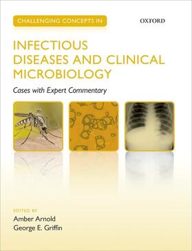 Arnold / Griffin | Challenging Concepts in Infectious Diseases and Clinical Microbiology | Buch | 978-0-19-966575-4 | sack.de