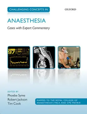 Syme / Jackson / Cook |  Challenging Concepts in Anaesthesia | Buch |  Sack Fachmedien