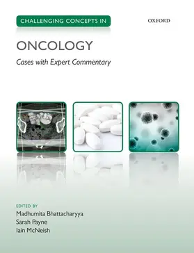 Bhattacharyya / Payne / McNeish |  Challenging Concepts in Oncology | Buch |  Sack Fachmedien
