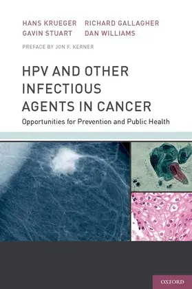 Krueger / Stuart / Gallagher |  Hpv and Other Infectious Agents in Cancer | Buch |  Sack Fachmedien