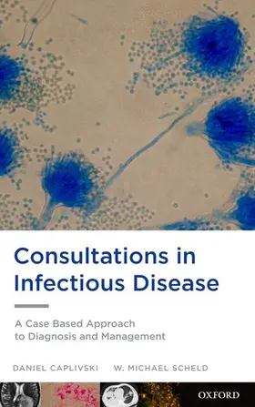 Caplivski / Scheld |  Consultations in Infectious Disease | Buch |  Sack Fachmedien