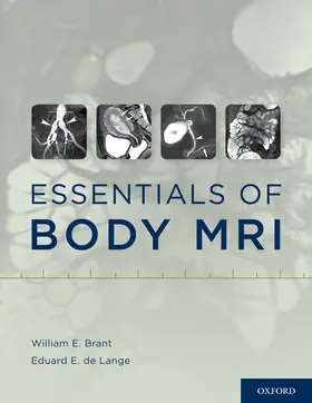 Brant / de Lange |  Essentials of Body MRI | Buch |  Sack Fachmedien