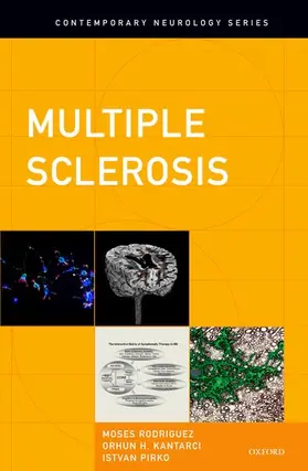 Rodriguez / Kantarci / Pirko |  Multiple Sclerosis | Buch |  Sack Fachmedien
