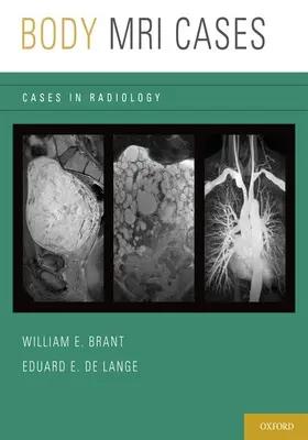 Brant / de Lange |  Body MRI Cases | Buch |  Sack Fachmedien