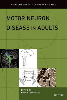 Bromberg | Motor Neuron Disease in Adults | Buch | 978-0-19-978311-3 | www.sack.de