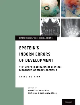 Erickson / Wynshaw-Boris |  Epstein's Inborn Errors of Development | Buch |  Sack Fachmedien