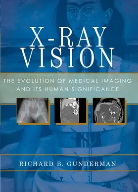 Gunderman |  X-Ray Vision | Buch |  Sack Fachmedien