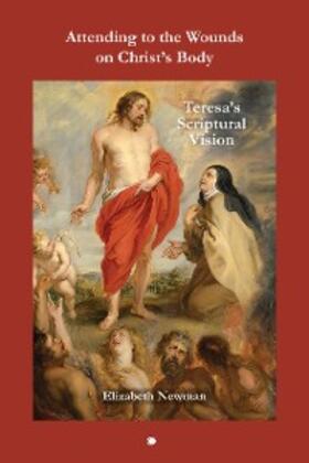 Newman |  Attending to the Wounds on Christ's Body | eBook | Sack Fachmedien