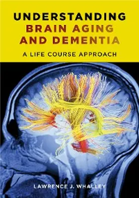 Whalley | Understanding Brain Aging and Dementia | E-Book | sack.de
