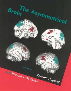 Hugdahl |  Asymmetrical Brain | Buch |  Sack Fachmedien