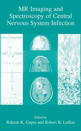 Gupta / Lufkin |  MR Imaging and Spectroscopy of Central Nervous System Infection | Buch |  Sack Fachmedien