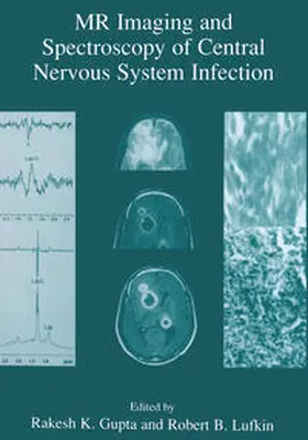 Gupta / Lufkin |  MR Imaging and Spectroscopy of Central Nervous System Infection | eBook | Sack Fachmedien