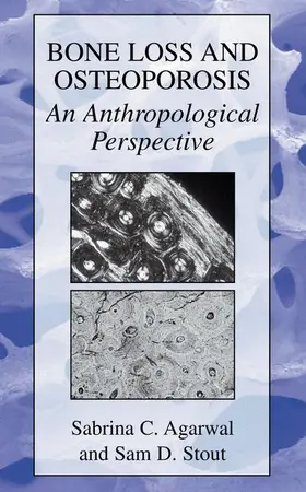 Stout / Agarwal |  Bone Loss and Osteoporosis | Buch |  Sack Fachmedien
