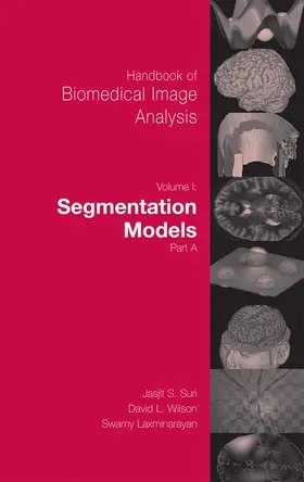 Laxminarayan / Wilson |  Handbook of Biomedical Image Analysis | Buch |  Sack Fachmedien